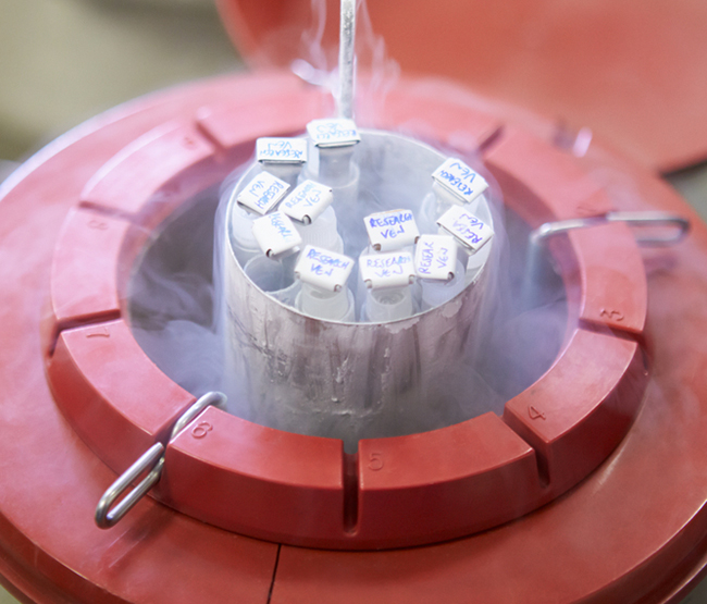 Fertilité masculine